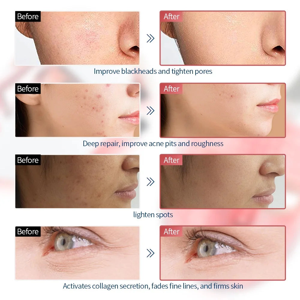 Wireless 7 Colors Face LED Mask Photon Facal Beauty Mask Skin Rejuvenation Anti Acne Repair Skin Tightening Anti Aging Skin Care